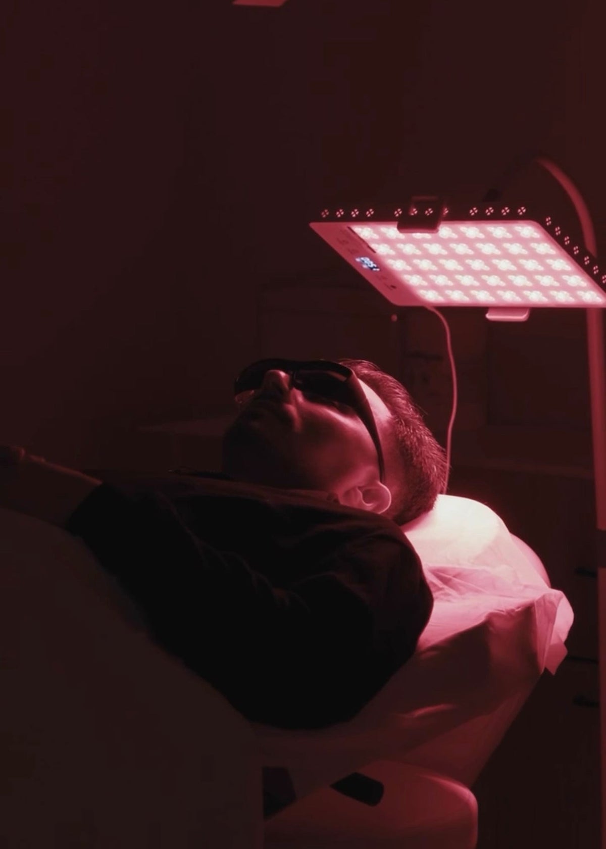 HAIR LOSS MESOTHERAPY